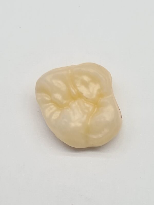 Protezų cirkonio vainiko gaminimo paslauga