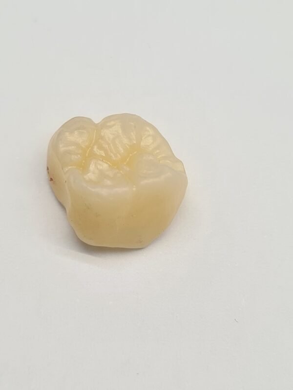 Protezų cirkonio vainiko gaminimo paslauga