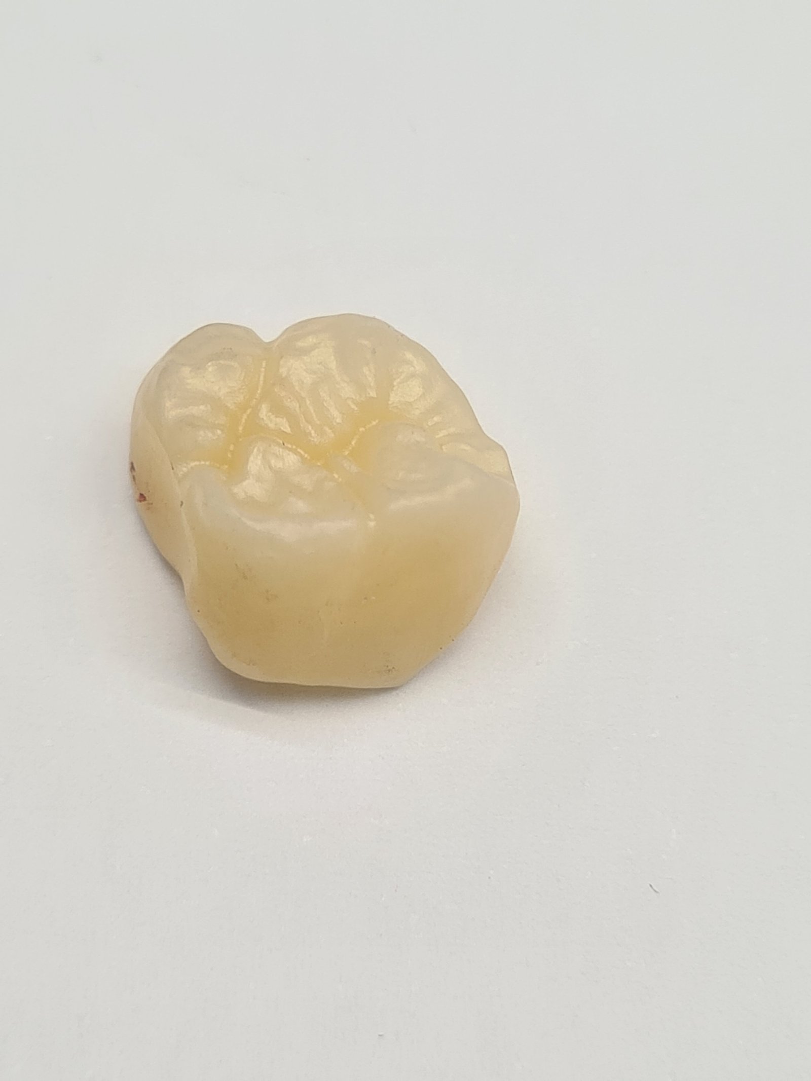 Protezų cirkonio vainiko gaminimo paslauga