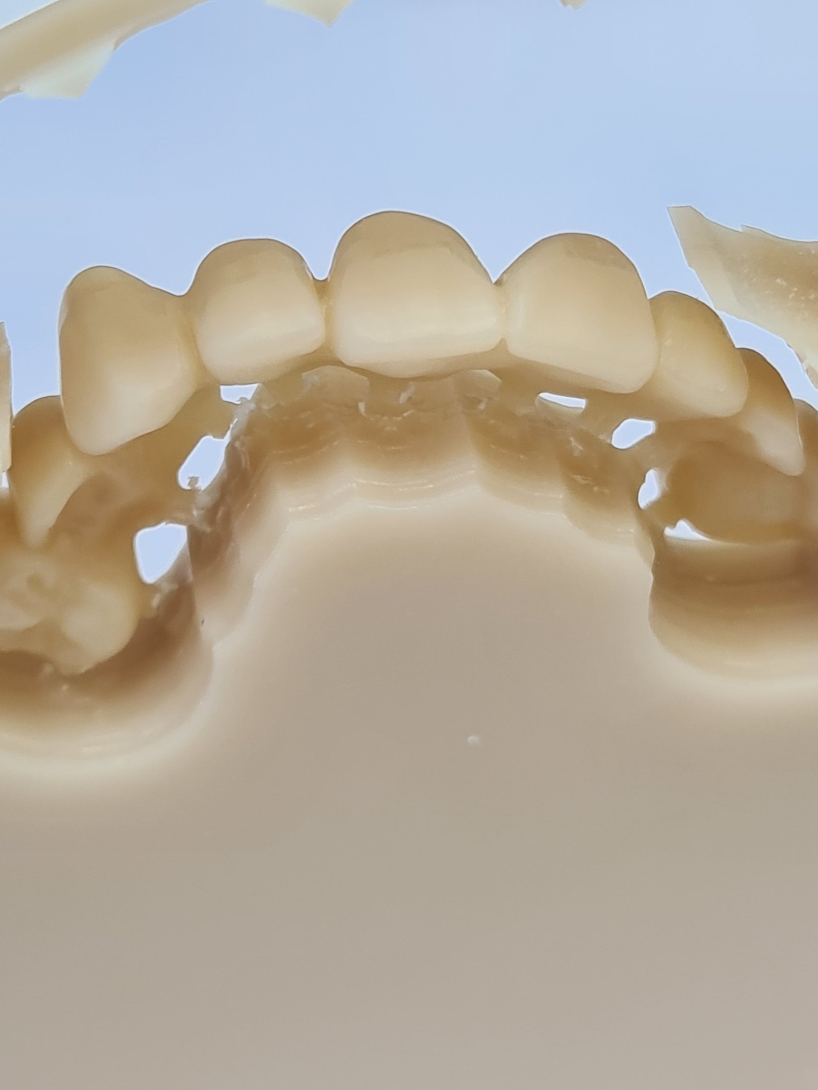 Protezų gamybos PMMA medžiaga paslauga