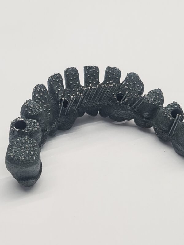 Protezų metalo spausdinimo paslauga